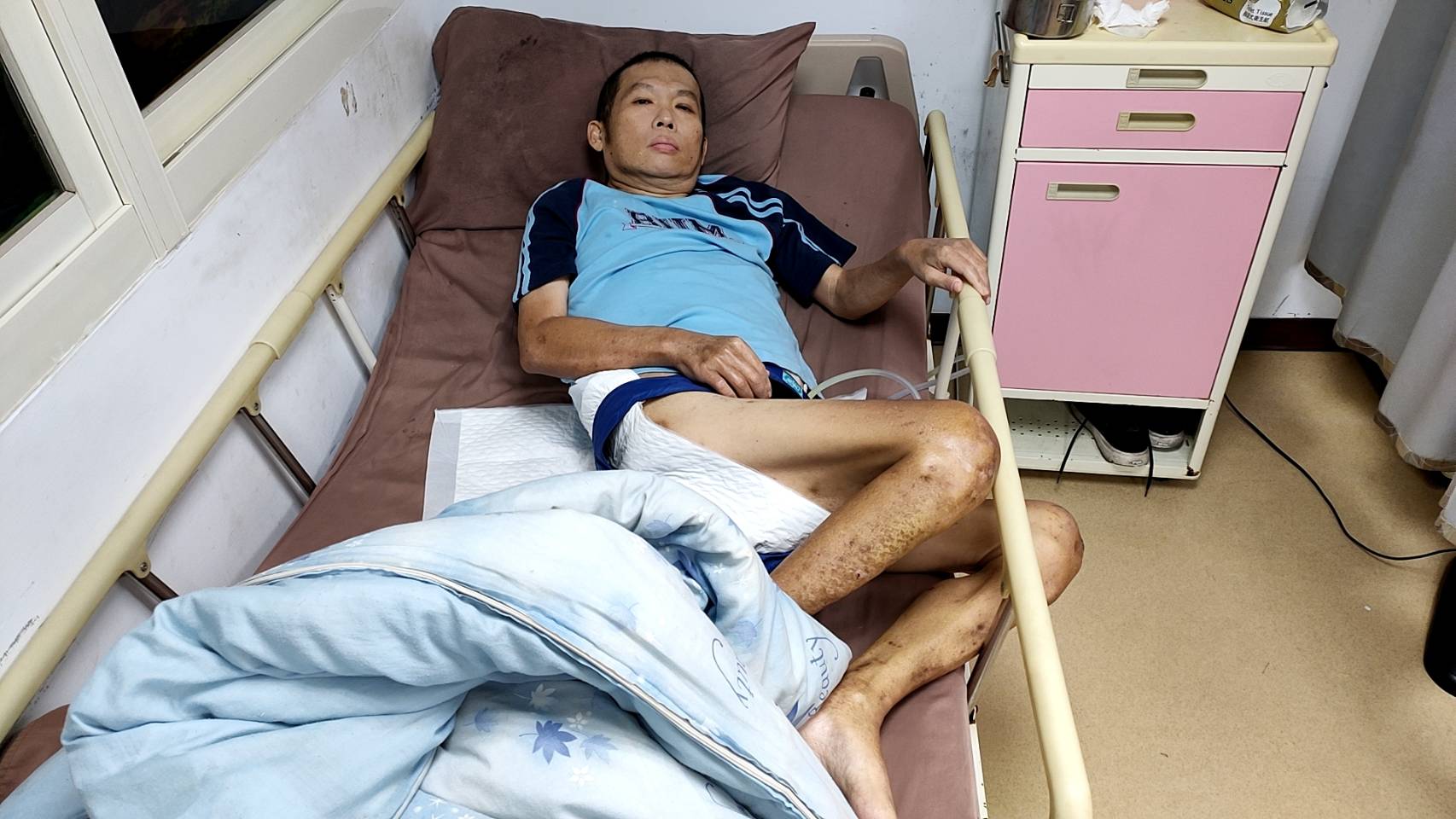 49歲阿憲去年10月中風,造成右側手腳無力、意識時好時壞。韓旭爾攝 49歲阿憲去年10月中風,造成右側手腳無力、意識時好時壞。韓旭爾攝