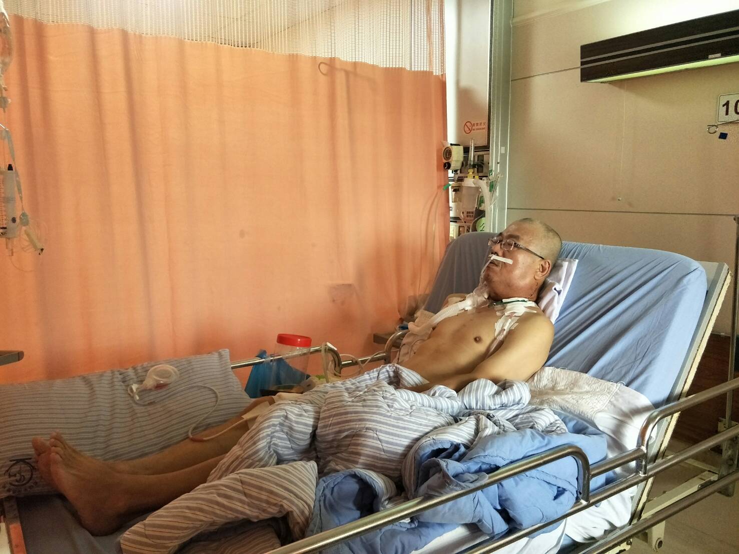 阿宗罹患4期喉癌,5月下旬進行全喉切除手術,使用永久性氣切孔輔助呼吸,術後可學習使用人工發聲器,有機會再講話。(家屬提供) 阿宗罹患4期喉癌,5月下旬進行全喉切除手術,使用永久性氣切孔輔助呼吸,術後可學習使用人工發聲器,有機會再講話。(家屬提供)